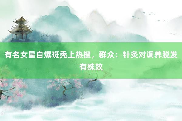 有名女星自爆斑秃上热搜，群众：针灸对调养脱发有殊效